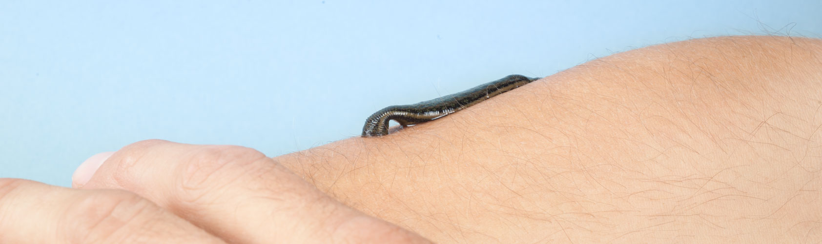 Blutegel Behandlung beim Menschen